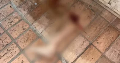 Mulher tem perna arrancada por veículo ao ser atropelada na Rua Brilhante